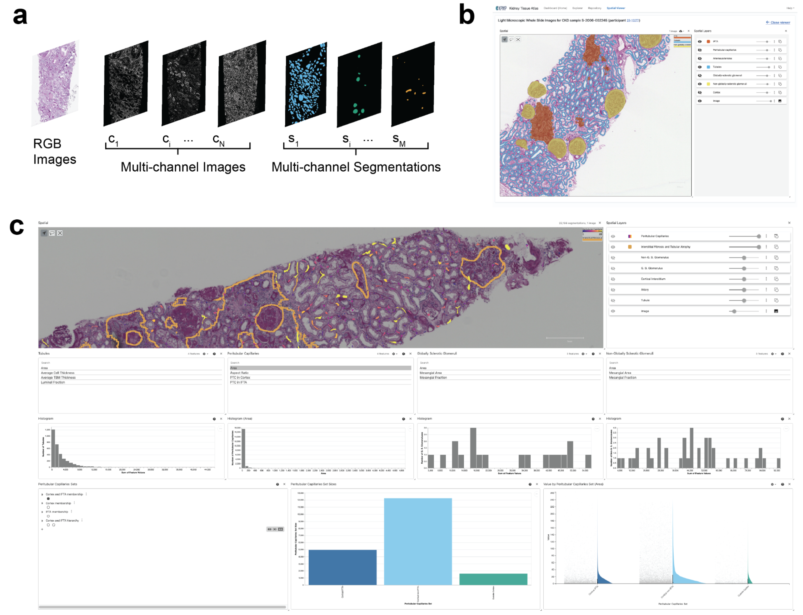 Figure 2 of manuscript. Top left shows a schematic of the layered spatial visualization approach in which segmentations of functional tissue units are displayed in multiple layers above a multi-channel image and an RGB histology image. Top right shows a screenshot of the visualization interface in the KPMP Kidney Tissue Atlas data portal website, showing a single whole-slide image and multiple FTU segmentations layered above. Bottom shows another screenshot, with histograms and violin/jitter plots below to display distributions of selected pathomic features.