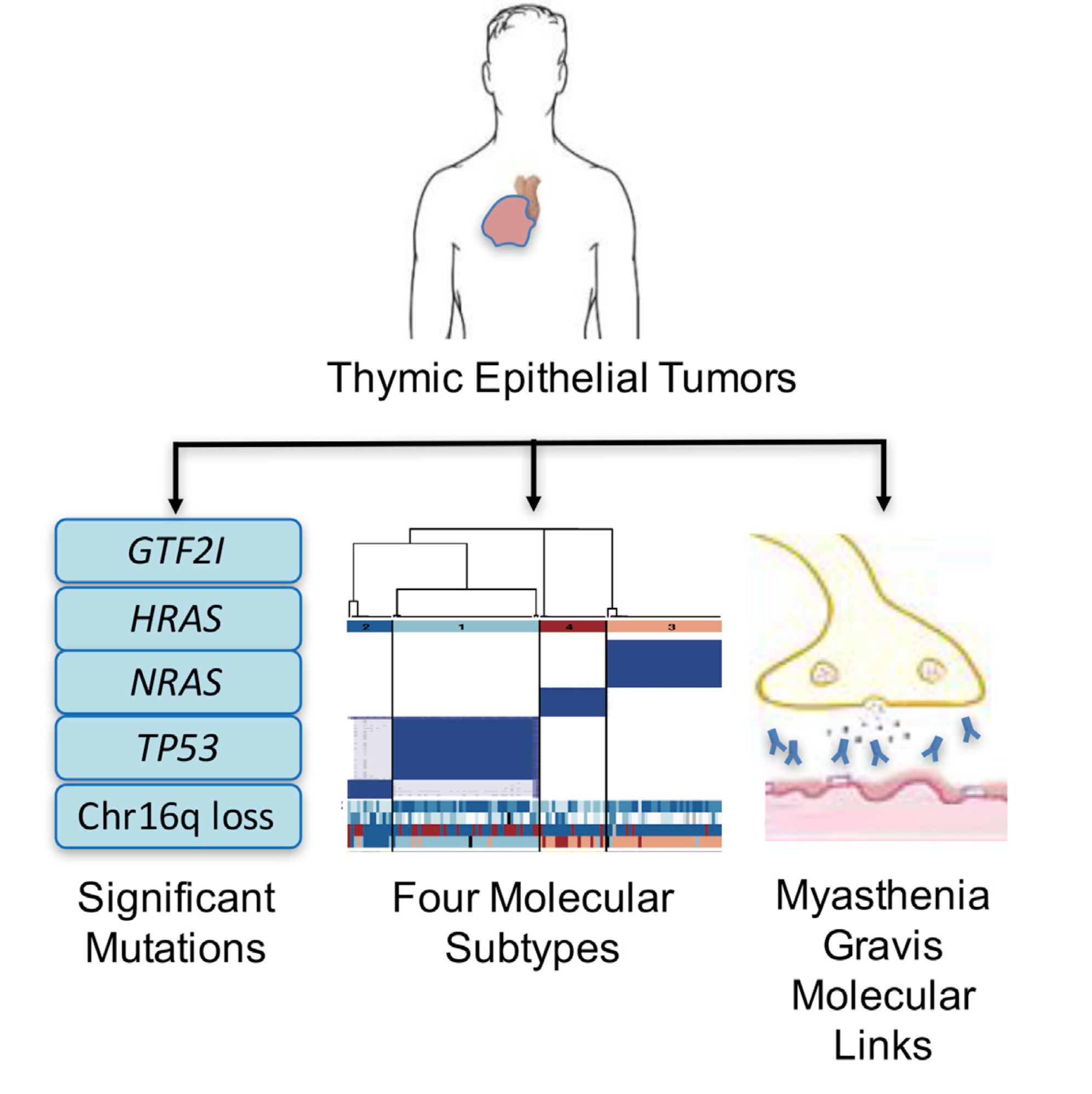 a graphical abstract with an icon of a human and arrows leading from the person to three aspects of thymic epithelial tumors