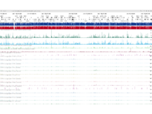 Publication page for "The chromatin landscape of healthy and injured cell types in the human kidney"