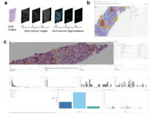 Publication page for "Interactive visualization of kidney micro-compartmental segmentations and associated pathomics on whole slide images"