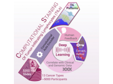 Publication page for "Spatial Organization and Molecular Correlation of Tumor-Infiltrating Lymphocytes Using Deep Learning on Pathology Images"